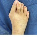 Expert Insights: Common Problems Treated by Podiatrists