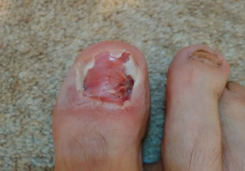 The Most Common and Serious Foot Injuries: An Expert's Perspective