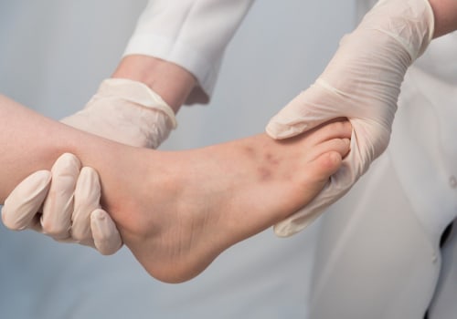 Do Podiatrists Do Pedicures? How Professional Foot Care Can Transform Your Foot Health