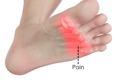 Expert Insights: Understanding the Most Painful Foot Conditions